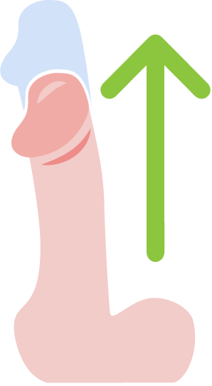 Zvětšení penisu